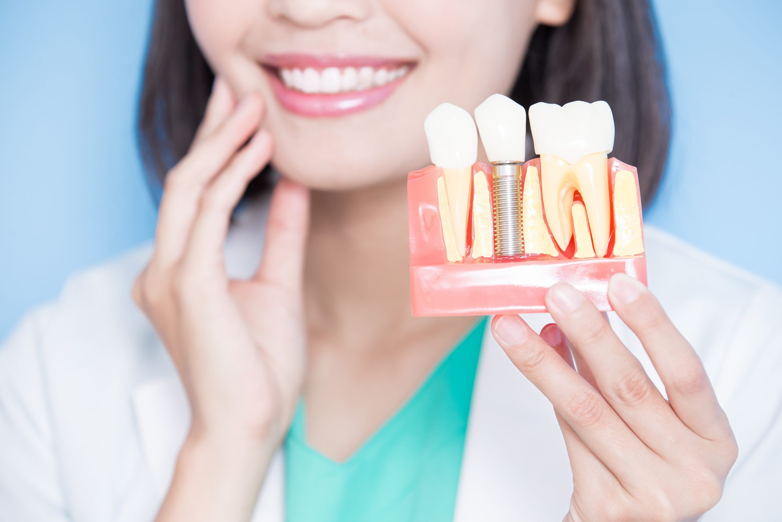 Woman smiling and holding up model of an installed dental implant.