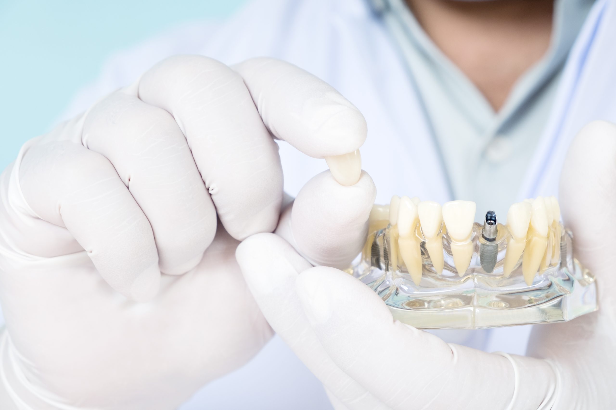 Dentist holding an artificial tooth with right hand and artificial jaw with right hand.